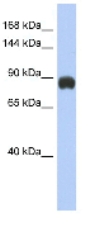 Anti-Metabotropic Glutamate Receptor 6 antibody (ab90866) at 1 µg/ml + Human fetal small intestine lysate at 10 µgSecondaryHRP conjugated anti-Rabbit IgG at 1/50000 dilution