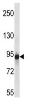 Anti-Metabotropic Glutamate Receptor 6 antibody (ab116555) at 1/100 dilution + MDA-MB-435 cell lysate at 35 µg