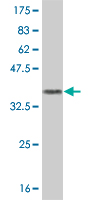 Western blot against tagged recombinant protein immunogen using ab55066 Metabotropic Glutamate Receptor 7 antibody at 1ug/ml.