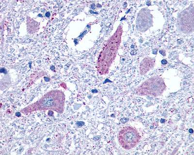 Ab13194 positively staining formalin fixed paraffin embedded brain, neurons.