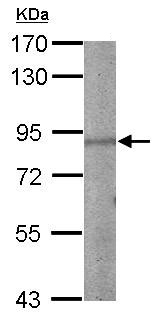 Anti-Metabotropic Glutamate Receptor 8 antibody - N-terminal (ab153946) at 1/1000 dilution + Mouse brain whole cell lysate at 50 µg