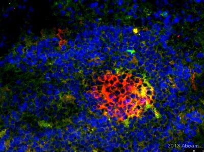 ab124953 staining Methionine Aminopeptidase 2 in Mouse spleen tissue sections by Immunohistochemistry (IHC-Fr - frozen sections). Tissue was fixed with Acetone and blocked with 5% Serum for 60 minutes at 25°C. Samples were incubated with primary antibody (1/25 in PBS + 5% goat serum) for 1 hours at 25°C. An Alexa Fluor®488-conjugated Goat anti-rabbit IgG polyclonal (1/400) was used as the secondary antibody.