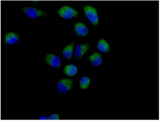 Immunofluorescent analysis of 4% paraformaldehyde fixed A375 cells labeling Methionyl Aminopeptidase 1 with ab185540 at 1/250 dilution. Secondary antibody Goat anti rabbit IgG (Alexa Fluor®488) at a 1/200 dilution. Counterstained with Dapi blue.