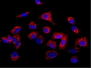 Immunofluorescent analysis of 4% paraformaldehyde fixed A549 cells labeling Methionyl Aminopeptidase 1 with ab185540 at 1/250 dilution. Secondary antibody Goat anti rabbit IgG (Alexa Fluor®555) at a 1/200 dilution. Counterstained with Dapi blue.