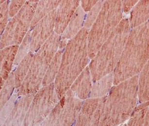 Immunohistochemical analysis of paraffin-embedded Rat skeletal muscle tissue labeling Methionyl Aminopeptidase 1 with ab185540 at 1/100 dilution. Counter stain Hematoxylin.