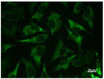 Ab50793, at a dilution of 1/10, staining Methionyl tRNA synthetase in Hela cell by Immunocytochemistry/Immunofluorescence. AlexaFluor®488 Goat anti-mouse IgG was used as the secondary antibody at a dilution of 1/200.
