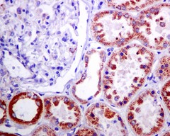 Immunohistochemical analysis of paraffin embedded Human kidney tissue labelling Methylmalonyl Coenzyme A mutase with ab133672 at 1/50.