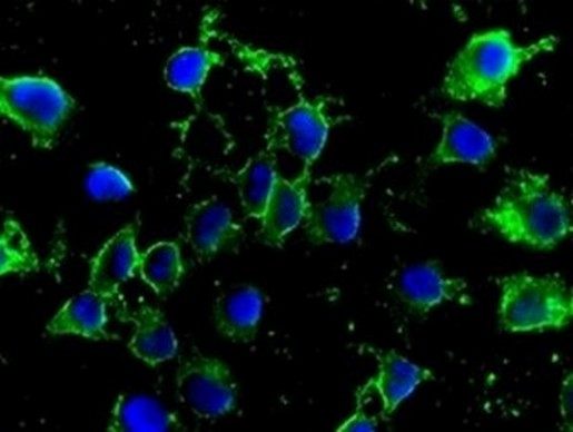 Immunofluorescent staining of HeLa cells labelling Methylmalonyl Coenzyme A mutase with ab133672 at 1/100.