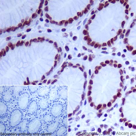 Immunohistochemical analysis of paraffin-embedded Human colon tissue labeling Histone H4 (acetyl K12) with ab177793 at 1/4000 dilution, followed by Goat Anti-Rabbit IgG H&L (HRP) (ab97051) at 1/500. Nucleus staining on Human colon tissue is observed. Counter stained with Hematoxylin.Negative control: Using PBS instead of primary antibody.