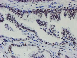 ab128528, at 1/150 dilution staining METT10D in paraffin-embedded Human prostate tissue by Immunohistochemistry.