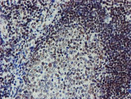 ab128528, at 1/150 dilution staining METT10D in paraffin-embedded adenocarcinoma of Human tonsil tissue by Immunohistochemistry.