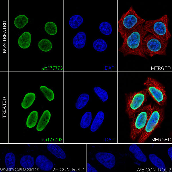 Immunofluorescent analysis of 4% paraformaldehyde-fixed, 0.1% Triton X-100 permeabilized HeLa (Human epithelial cells from cervix adenocarcinoma) cells, treated with Trichostatin A (500 ng/ml) for 4 hours or untreated, labeling Histone H4 (acetyl K12) with ab177793 at 1/2000 dilution, followed by Goat anti-rabbit IgG (Alexa Fluor® 488) (ab150077) secondary antibody at 1/500 dilution (green). Confocal image showing nuclear staining on HeLa cell line is observed. Acetylation level increased after treatment with Trichostatin A (500 ng/ml) for 4 hours. The nuclear counter stain is DAPI (blue). Tubulin is detected with ab7291 (anti-Tubulin mouse mAb) at 1/1000 dilution and ab150120 (AlexaFluor®594 Goat anti-Mouse secondary) at 1/500 dilution (red).The negative controls are as follows;1. ab177793 at 1/2000 dilution followed by ab150120 (AlexaFluor®594 Goat anti-Mouse secondary) at 1/500 dilution.2. ab7291 (anti-Tubulin mouse mAb) at 1/1000 dilution followed by ab150077 (Alexa Fluor®488 Goat
