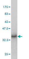 Western blot against tagged recombinant protein immunogen using ab57797 MFRP antibody at 1ug/ml.