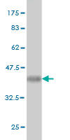 Western blot against tagged recombinant protein immunogen using ab58223 MGAT3 antibody at 1ug/ml.