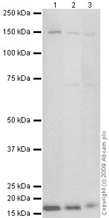 All lanes : Anti-MGAT5 antibody (ab68595) at 1 µg/mlLane 1 : TE 671 (Human Rhabdomyosarcoma) Whole Cell LysateLane 2 : Jurkat (Human T cell lymphoblast-like cell line) Whole Cell LysateLane 3 : Jurkat Whole Cell Lysate - Staurosporine Treated (24hr, 500nM)Lysates/proteins at 10 µg per lane.SecondaryGoat polyclonal to Rabbit IgG - H&L - Pre-Adsorbed (HRP) at 1/3000 dilutionPerformed under reducing conditions.
