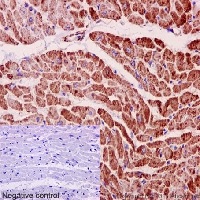 Immunohistochemical analysis of paraffin-embedded Human cardiac muscle tissue labeling MGST3 with ab192254 at 1/500 dilution followed by pre-diluted HRP Polymer for Rabbit IgG secondary antibody and counter-stained with Hematoxylin.(inset: negative control).
