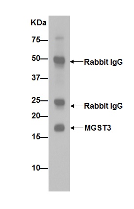 Western blot analysis of immunoprecipitation pellet from HepG2 cell lysate immunoprecipitated using ab192254 at 1/20 dilution.Secondary: Goat Anti-Rabbit IgG, (H+L), Peroxidase conjugate at 1/1000 dilution.