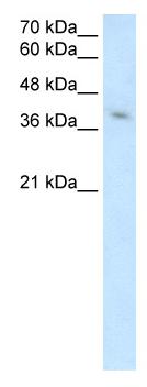 Anti-MICA antibody (ab61282) at 2.5 µg/ml + Jurkat cell lysate at 10 µgSecondaryHRP conjugated anti-Rabbit IgG at 1/50000 dilution