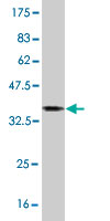 Western blot against tagged recombinant protein immunogen using ab55444 MID1 antibody at 1ug/ml.