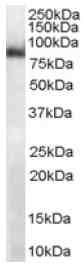 Anti-MID2 antibody (ab14749) at 1 µg/ml + Mouse Heart lysate (RIPA buffer, 35µg total protein per lane).