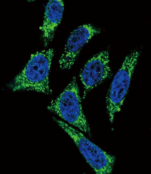Confocal immunofluorescent analysis of HeLa cells labeling Midkine with ab170820 at 1/10 dilution, followed by Alexa Fluor 488-conjugated goat anti-rabbit lgG (green). DAPI was used to stain the cell nuclear (blue).