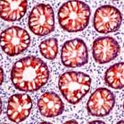 ab17787 Milk Fat Globule Membrane Protein staining in human tissue. The primary antibody was diluted 1/50, and incubated for 30 minutes at room temperature.