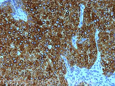 IHC image of ab17787 staining in human normal breast formalin fixed paraffin embedded tissue section, performed on a Leica BondTM system using the standard protocol F. The section was pre-treated using heat mediated antigen retrieval with sodium citrate buffer (pH6, epitope retrieval solution 1) for 20 mins. The section was then incubated with ab17787, 1µg/ml, for 15 mins at room temperature and detected using an HRP conjugated compact polymer system. DAB was used as the chromogen. The section was then counterstained with haematoxylin and mounted with DPX.For other IHC staining systems (automated and non-automated) customers should optimize variable parameters such as antigen retrieval conditions, primary antibody concentration and antibody incubation times.