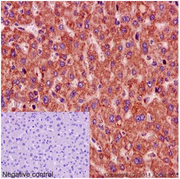 Immunohistochemical analysis of paraffin-embedded Human liver tissue labeling Mimitin with ab192267 at 1/200 dilution, followed by prediluted HRP Polymer for Rabbit/Mouse IgG. Counter stained with Hematoxylin. Negative control also shown.