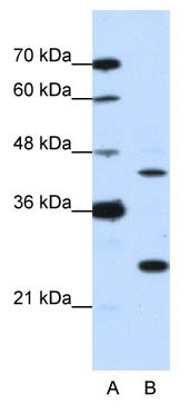 Anti-MINA53 antibody (ab50908) at 1.25 µg/ml + HepG2 cell Lysate (10µg)SecondaryHRP conjugated anti-Rabbit IgG at 1/50000 dilution