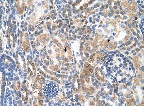 Immunohistochemistry (Formalin/PFA-fixed paraffin-embedded sections) analysis of human kidney tissue labelling Mineralocorticoid Receptor with ab62532 at 4-8µg/ml. Arrows indicate positively labelled epithelial cells of the renal tubule. Magnification: 400X.