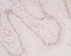 ab41912 staining Mineralocorticoid Receptor in human large intestine paraffin section (20-40ug/mL) by Immunohistochemistry, formalin-fixed paraffin embedded sections.