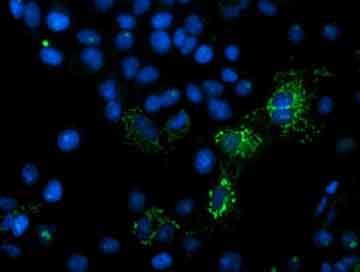 Immunofluorescent analysis of COS7 cells transiently transfected with pCMV6-ENTRY MIPEP labelling MIPEP with ab131647, at 1/100 dilution.