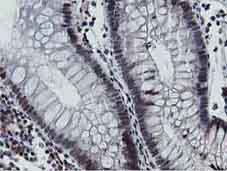 Immunohistochemical analysis of Paraffin-embedded Human colon tissue labelling MIPEP with ab131647 at 1/150.