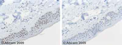 Ab59232 staining Human normal skin. Staining is localized to the nucleus.Left panel: with primary antibody at 4 ug/ml. Right panel: isotype control.Sections were stained using an automated system DAKO Autostainer Plus , at room temperature. Sections were rehydrated and antigen retrieved with the Dako 3-in-1 AR buffer citrate pH 6.0 in a DAKO PT Link. Slides were peroxidase blocked in 3% H2O2 in methanol for 10 minutes. They were then blocked with Dako Protein block for 10 minutes (containing casein 0.25% in PBS), then incubated with primary antibody for 20 minutes, and detected with Dako Envision Flex amplification kit for 30 minutes. Colorimetric detection was completed with diaminobenzidine for 5 minutes. Slides were counterstained with Haematoxylin and coverslipped under DePeX. Please note that for manual staining we recommend to optimize the primary antibody concentration and incubation time (overnight incubation), and amplification may be required.
