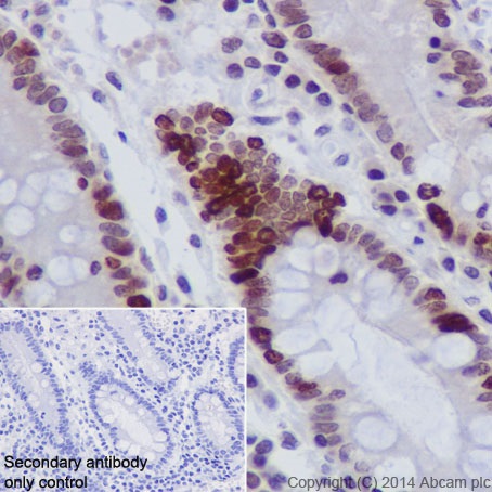 Immunohistochemical analysis of paraffin-embedded Human stomach tissue labeling Histone H4 (crotonyl K5 + K8) with ab177844 at 1/100 dilution, followed by Goat Anti-Rabbit IgG H&L (HRP) (ab97051) secondary antibody at 1/500 dilution. Nucleus staining on Human stomach tissue is observed. Counter stained with Hematoxylin.Secondary antibody only control: Used PBS instead of primary antibody, secondary antibody is Goat Anti-Rabbit IgG H&L (HRP) (ab97051) at 1/500 dilution.