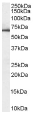 Anti-Mitochondrial Pyruvate dehydrogenase kinase 1 antibody (ab47987) at 1 µg/ml + Human Liver lysate (35µg protein in RIPA buffer).