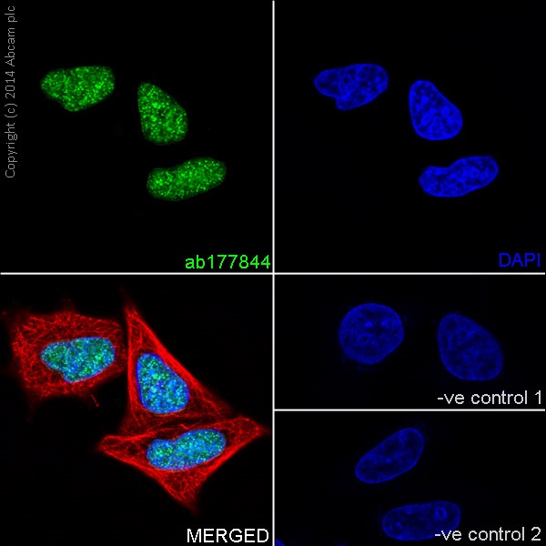 Immunofluorescent analysis of 4% paraformaldehyde-fixed, 0.1% Triton X-100 permeabilized HeLa (Human epithelial cells from cervix adenocarcinoma) cells labeling Histone H4 (crotonyl K5 + K8) with ab177844 at 1/250 dilution, followed by Goat anti-rabbit IgG (Alexa Fluor® 488) (ab150077) secondary antibody at 1/500 dilution (green). Confocal image showing nuclear staining on HeLa cell line. The nuclear counter stain is DAPI (blue). Tubulin is detected with ab7291 (anti-Tubulin mouse mAb) at 1/1000 dilution and ab150120 (AlexaFluor®594 Goat anti-Mouse secondary) at 1/500 dilution (red).The negative controls are as follows:-ve control 1: ab177844 at 1/250 dilution followed by ab150120 (AlexaFluor®594 Goat anti-Mouse secondary) at 1/500 dilution.-ve control 2: ab7291 (anti-Tubulin mouse mAb) at 1/1000 dilution followed by ab150077 (Alexa Fluor®488 Goat Anti-Rabbit IgG H&L) at 1/500 dilution.