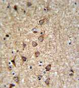 IHC analysis in formalin fixed and paraffin embedded Human brain tissue followed by peroxidase conjugation of the secondary antibody and DAB staining, using ab102959 at a dilution of 1/50.