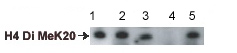 All lanes : Anti-Histone H4 (di methyl K20) antibody - ChIP Grade (ab9052) at 1/2000 dilutionLane 1 : yH4 17-24 peptideLane 2 : Unmodified yH4 17-24 peptideLane 3 : Mono methyl K20 yH4 17-24 peptideLane 4 : Di methyl K20 yH4 17-24 peptideLane 5 : Tri methyl K20 yH4 17-24 peptideBlocking peptides at 1 µg/ml per lane.Performed under reducing conditions.Steve Sanders, Tony Kouzarides lab, University of Cambridge