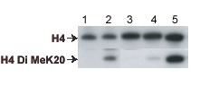 All lanes : Upper blot - Histone H4 antibody (gift of A. Verreault) Lower blot - Rabbit polyclonal to Histone H4 di methyl K20 (ab9052) at 1/2000Lane 1 : S.cerevisiae extractLane 2 : S.pombe extractLane 3 : S.pombe rH4Lane 4 : Drosophila rH4Lane 5 : Histones (Roche)