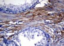 Immunohistochemical analysis of formalin fixed/ paraffin embedded Human prostate tissue labeling Mitofusin 1 with ab170554 at a 1/150 dilution.