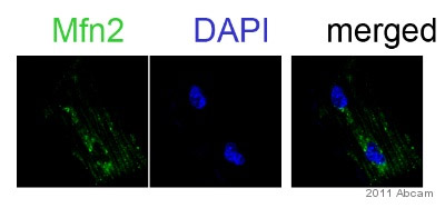 ab50843 staining Mitofusin 2 in murine cardiac myocyte cells by Immunocytochemistry/ Immunofluorescence. Cells were fixed in formaldehyde, permeabilized using 1% Triton X-100, blocked with 10% serum for 1 hour at room temperature, then incubated with ab50843 at a 1/200 dilution for 1 hour. The secondary used was an Alexa-Fluor 488 conjugated goat anti-rabbit polyclonal used at a 1/500 dilution.See Abreview