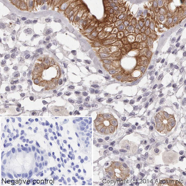 IHC image of Mitofusin 2 staining in a section of formalin-fixed paraffin-embedded normal human colon tissue*. The section was pre-treated using pressure cooker heat mediated antigen retrieval with sodium citrate buffer (pH6) for 30mins, and incubated overnight at +4°C with ab195543 at 1/100 dilution. DAB was used as the chromogen (ab103723), diluted 1/100 and incubated for 10min at room temperature. The section was counterstained with haematoxylin and mounted with DPX. The inset negative control image is taken from an identical assay without primary antibody.For other IHC staining systems (automated and non-automated) customers should optimize variable parameters such as antigen retrieval conditions, primary antibody concentration and antibody incubation times.*Tissue obtained from the Human Research Tissue Bank, supported by the NIHR Cambridge Biomedical Research Centre