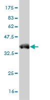 Western blot against tagged recombinant protein immunogen using ab57854 Mixl1 antibody at 1ug/ml.