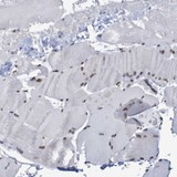 ab121340, at 1/100 dilution, staining MLK2 in Paraffin-embedded Human Skeletal tissue by Immunohistochemistry.