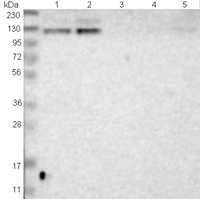 All lanes : Anti-Mkl2 antibody (ab121340) at 1/250 dilutionLane 1 : RT 4 lysateLane 2 : U 251 MG lysateLane 3 : Human plasma lysateLane 4 : Human liver lysateLane 5 : Human tonsil lysatedeveloped using the ECL technique