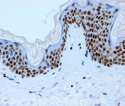 IHC image of Histone H4 (tri methyl K20) staining in normal human skin formalin fixed paraffin embedded tissue section, performed on a Leica BondTM system using the standard protocol F. The section was pre-treated using heat mediated antigen retrieval with sodium citrate buffer (pH6, epitope retrieval solution 1) for 20 mins. The section was then incubated with ab78517, 1µg/ml, for 15 mins at room temperature and detected using an HRP conjugated compact polymer system. DAB was used as the chromogen. The section was then counterstained with haematoxylin and mounted with DPX.