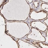 ab121106 at 1/50 dilution staining MKRN1 in Paraffin-emebedded Human Thyroid gland tissue by Immunohistochemistry. Note: strong cytoplasmic positivity in glandular cells.