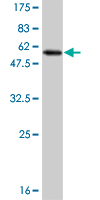 Anti-MLF2 antibody (ab56378) at 5 µg/ml + 0.2 µg/lane of full length recombinant MLF2 protein with a tag SecondaryGoat anti mouse IgG (H&L)-HRP conjugate at 1/5000 dilution