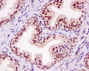 Immunohistochemical analysis of paraffin embedded Human prostate tissue labeling MLF2 with ab180184 at 1/50.